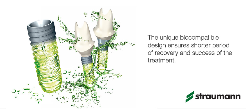 Implant Straumann sở hữu nhiều ưu điểm vượt trội mà các dòng trụ khác không có
