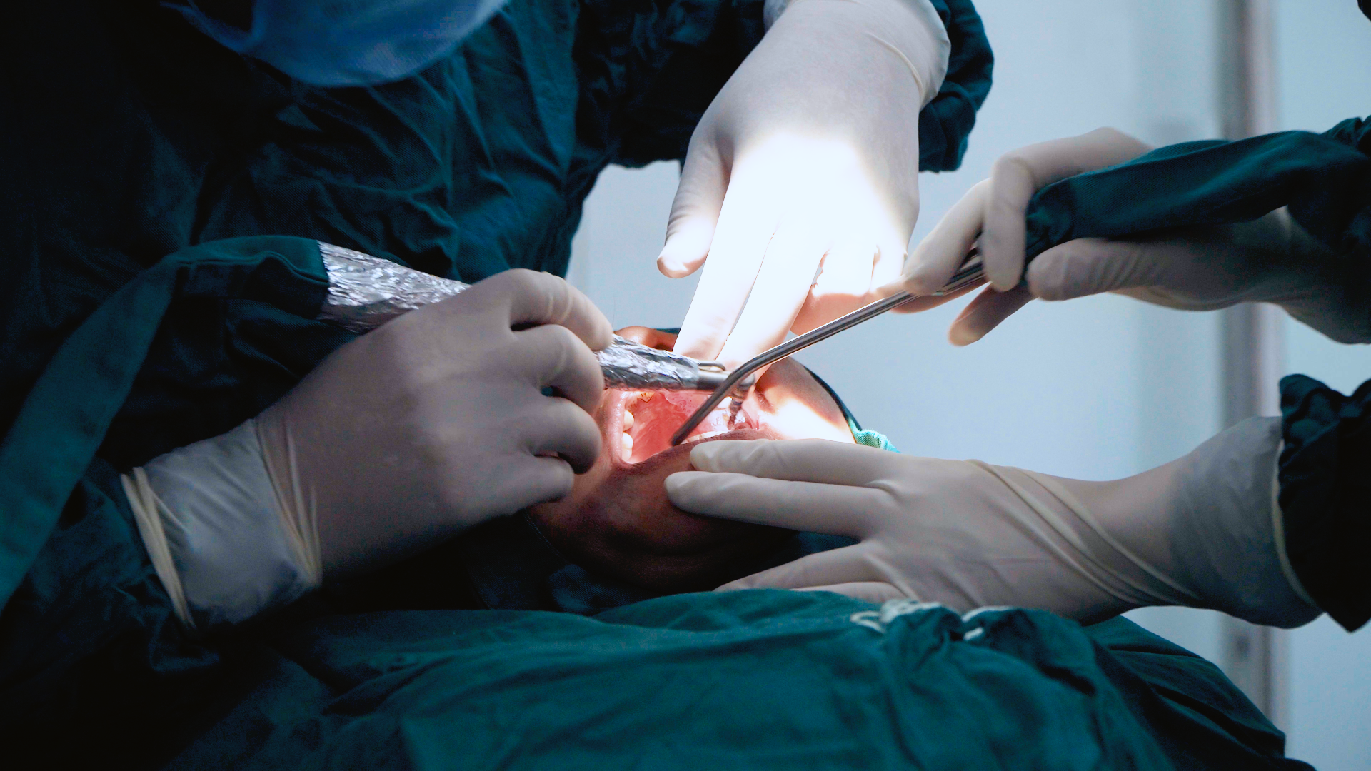 Vì sao nhiều người chọn BS Bùi Hưng – Nha khoa Olympia để cấy ghép Implant?