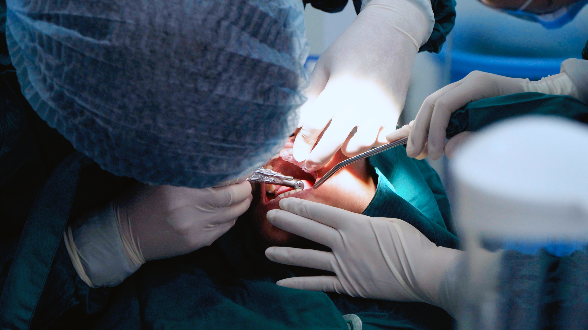 Vì sao máng hướng dẫn phẫu thuật được ví như “trợ lý vô hình”?