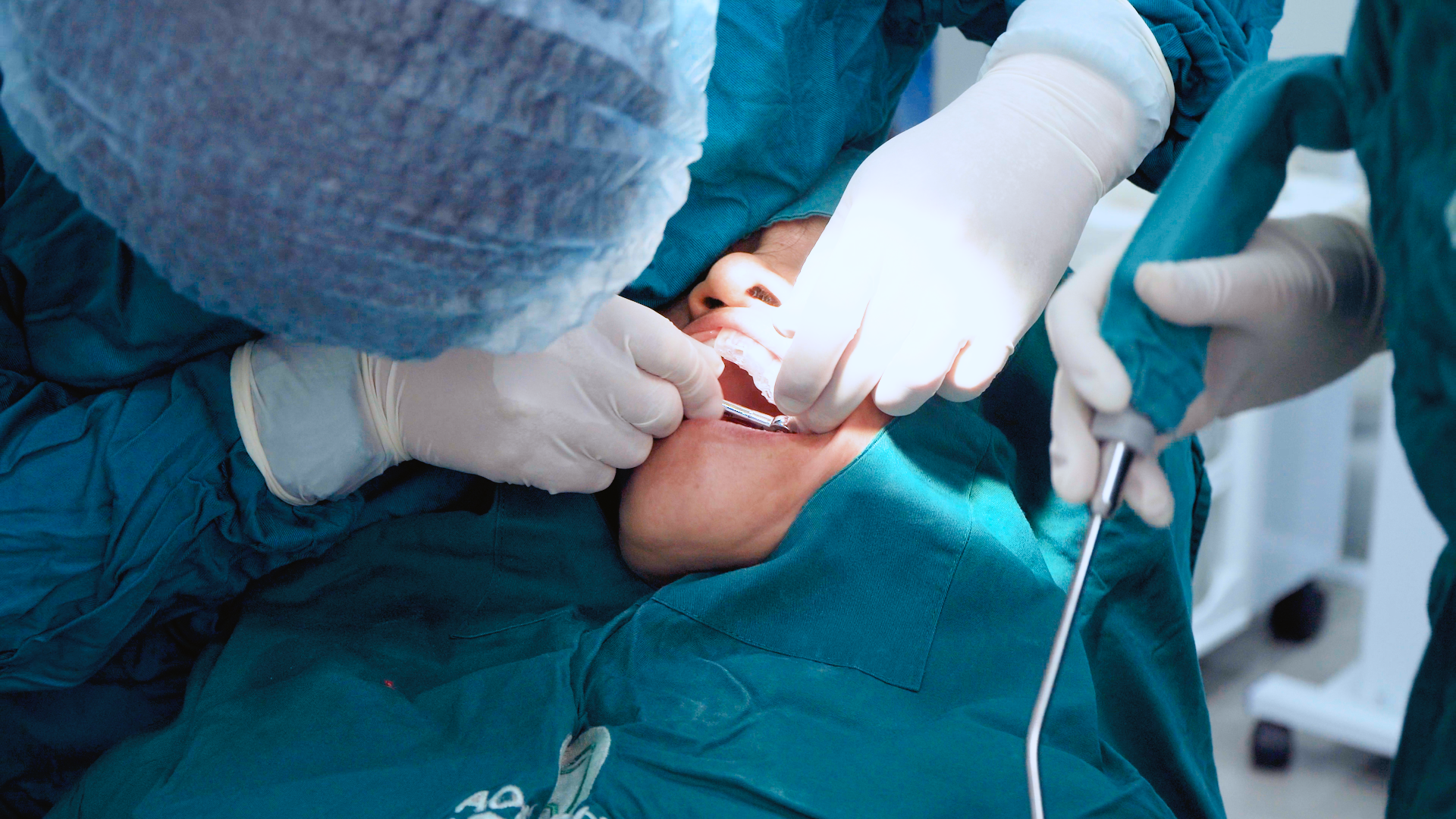 Trồng răng không cần ghép xương – có được không?