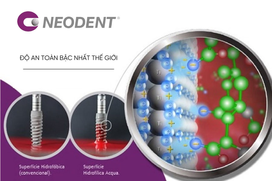 Bề mặt trụ Implant Neodent của Thụy Sỹ