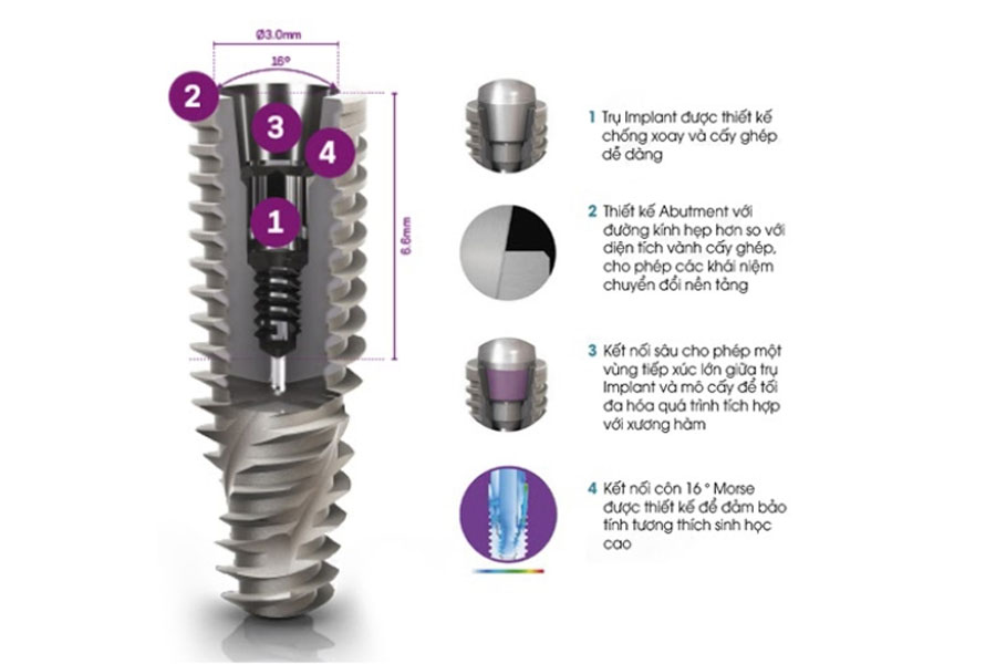 Cấu tạo và thành phần của trụ Implant Neodent của Thụy Sỹ