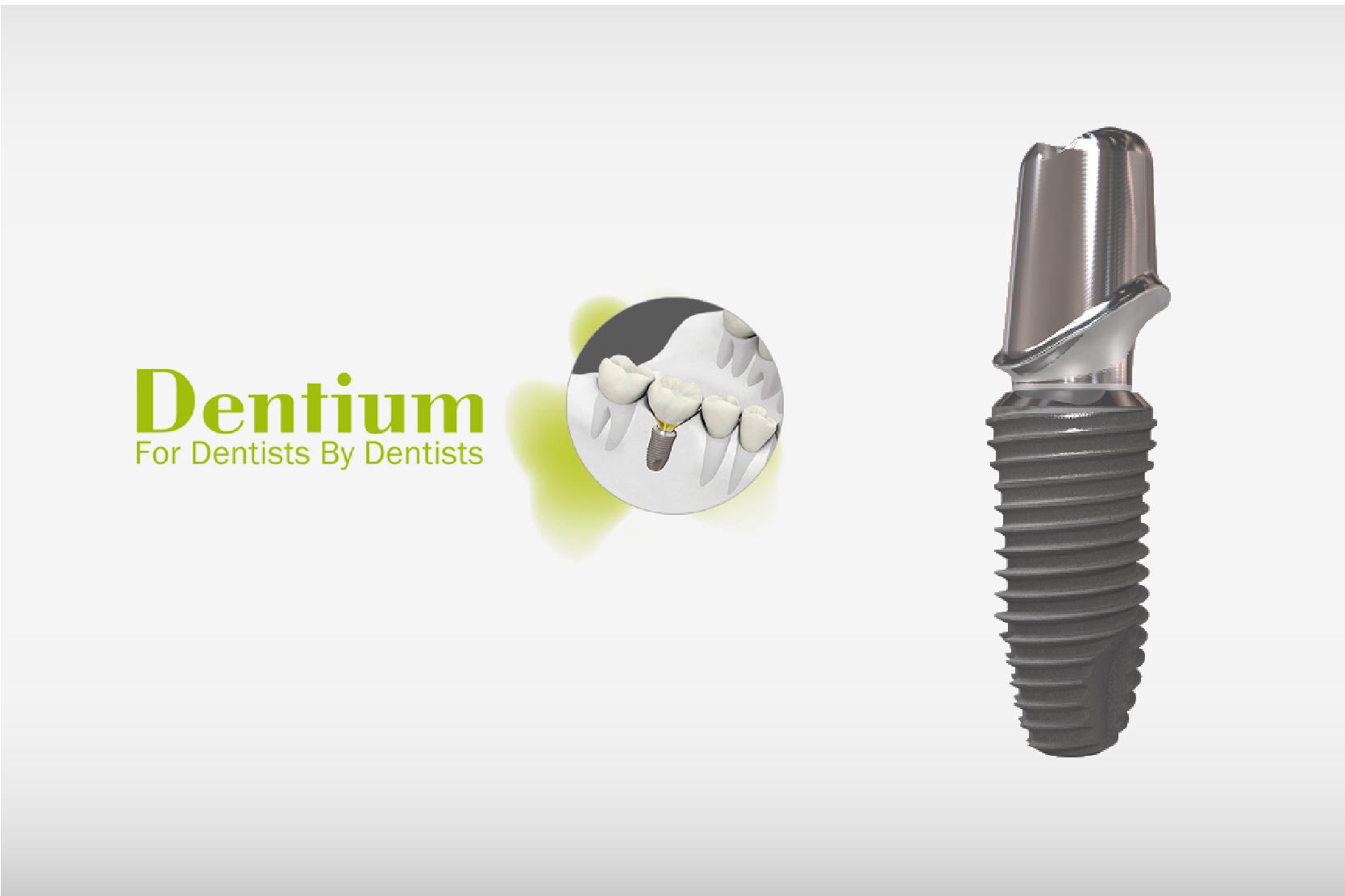 Trụ Implant DENTIUM Hàn Quốc: Giải Pháp Phục Hình Răng Mất Đáng Tin Cậy
