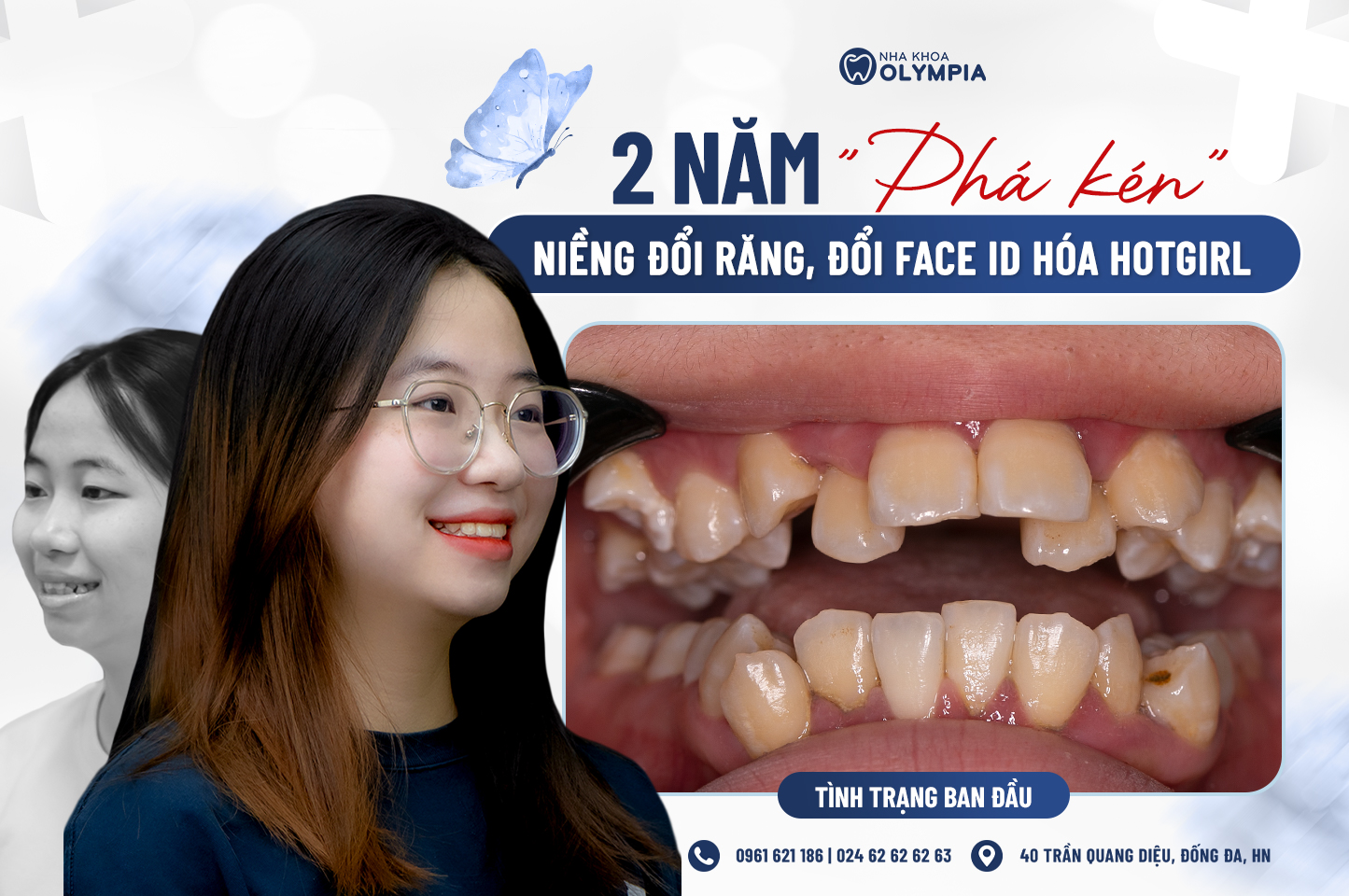 Nha khoa Olympia – nơi những hành trình “phá kén” bắt đầu