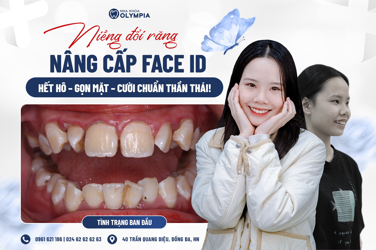 Hình ảnh Before – After: Thay đổi ngoạn mục sau 2 năm của cô nàng Phạm Thảo Linh