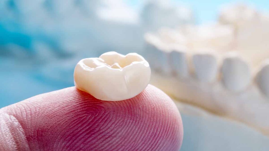 Thẩm mỹ răng sứ là gì?