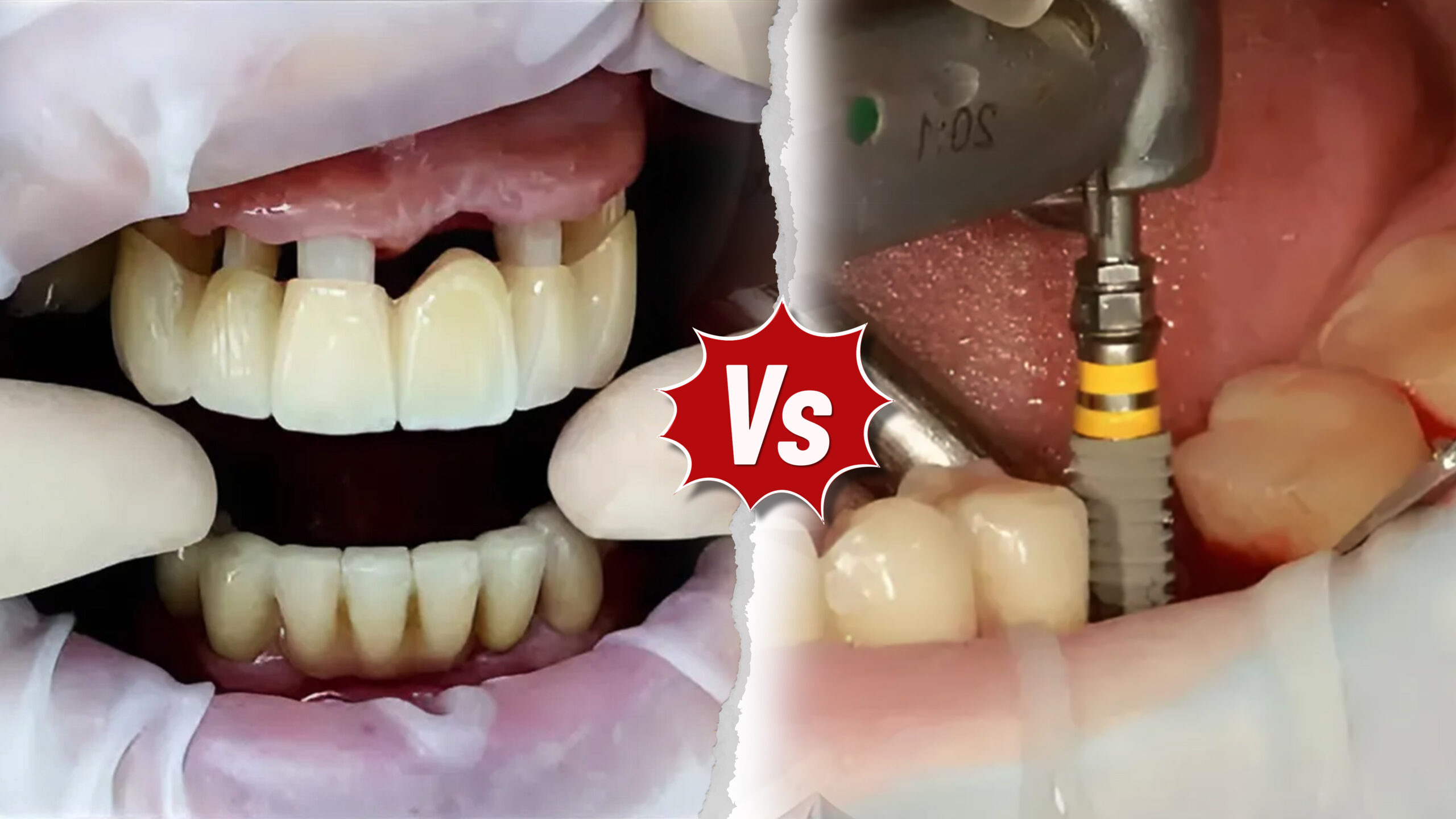 Những lầm tưởng thường gặp khi so sánh hai phương pháp