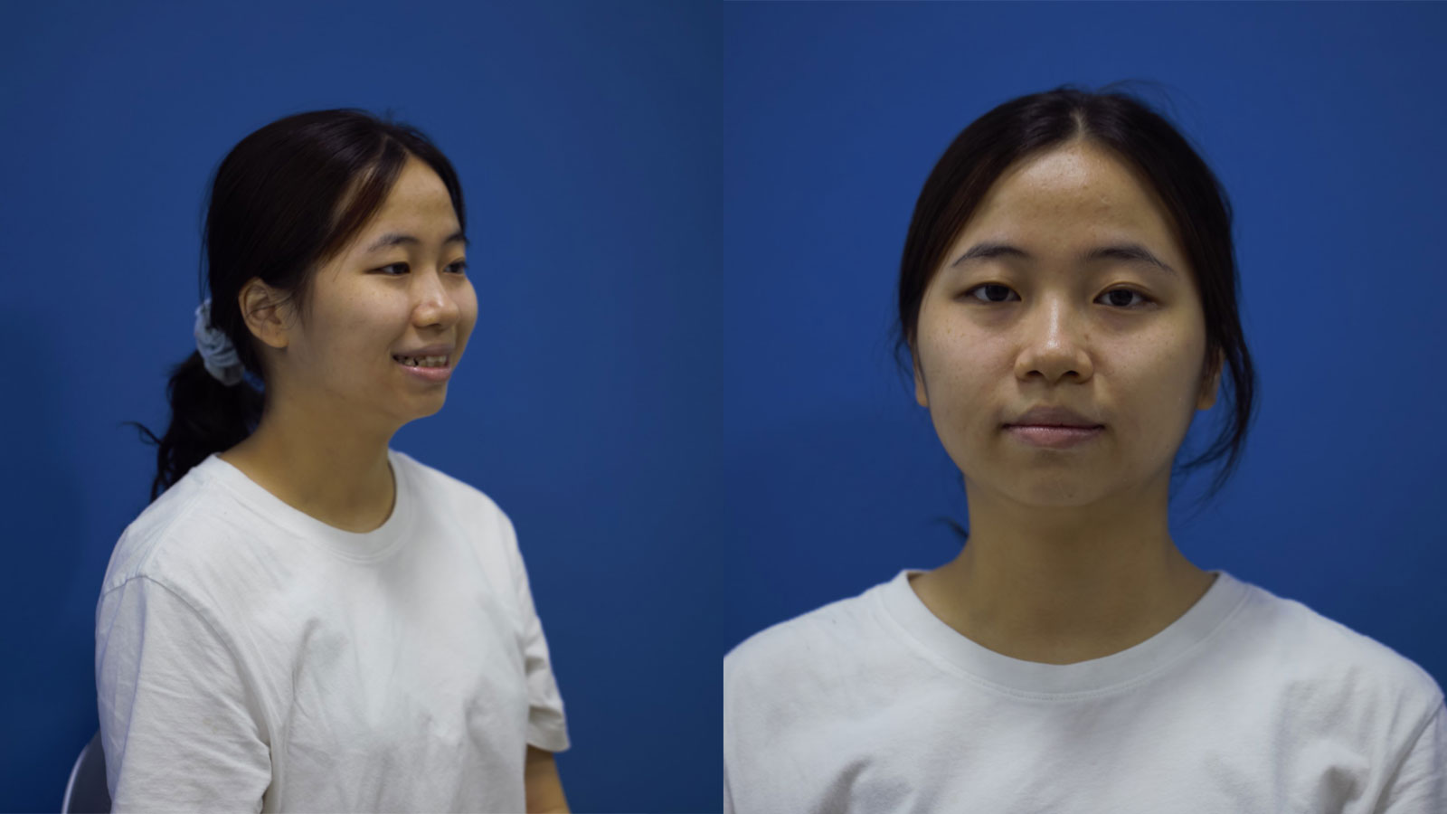 Có một Anh Thư từng ngại cười vì… chính nụ cười của mình