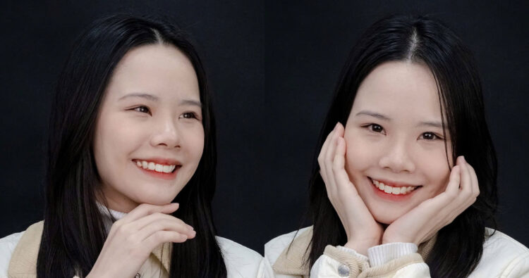 Kết quả sau 2 năm: Thay đổi toàn diện từ nụ cười đến khuôn mặt