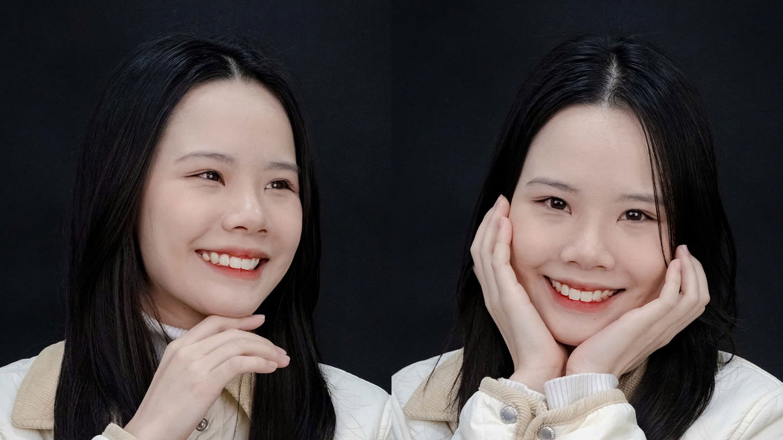 Kết quả sau 2 năm: Thay đổi toàn diện từ nụ cười đến khuôn mặt