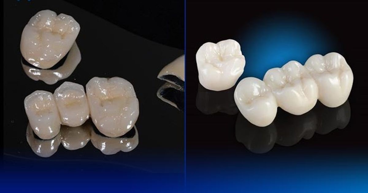 Răng toàn sứ phù hợp với công nghệ hiện đại hơn