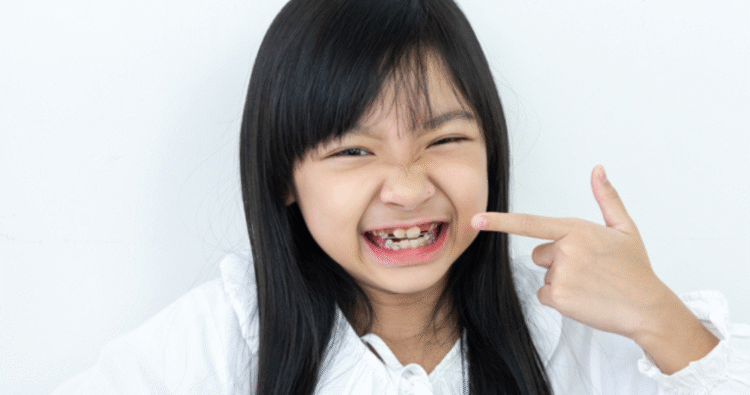 Dấu hiệu cho thấy trẻ cần đi khám răng sớm hơn bình thường