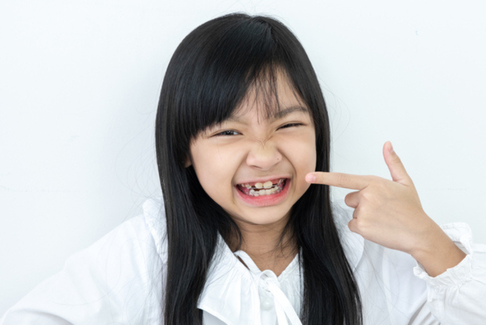 Dấu hiệu cho thấy trẻ cần đi khám răng sớm hơn bình thường
