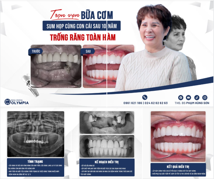 Trọn vẹn bữa cơm bên gia đình của Phan Hải Yến sau hình trình trồng răng