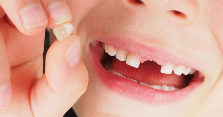 Răng sữa và răng vĩnh viễn là gì?