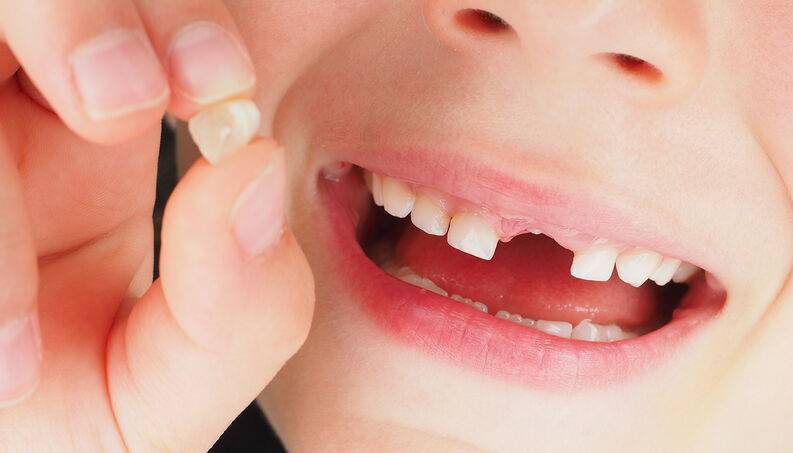 Răng sữa và răng vĩnh viễn là gì?