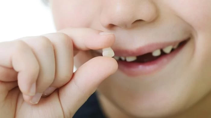 3 dấu hiệu cần đưa trẻ đến nha khoa khi răng sữa lung lay