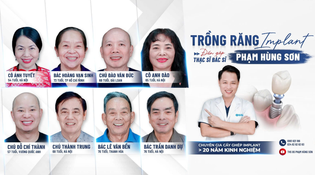 Trồng răng công nghệ số hóa chính xác