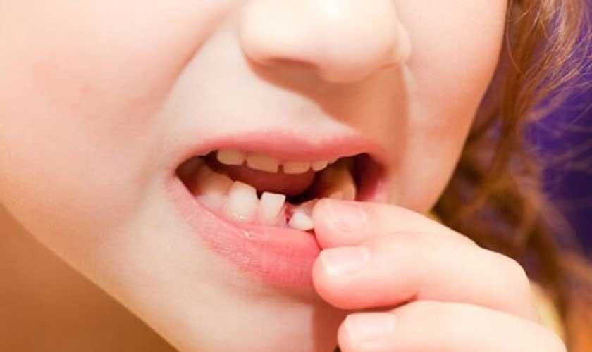 Nhổ răng sữa đúng cách tại nhà – khi nào thì được phép?