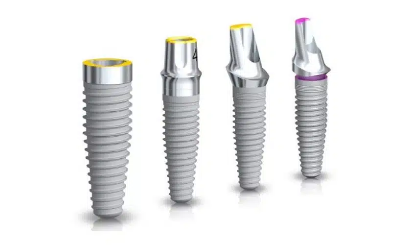 Abutment cá nhân hóa tạo độ khít tối đa – giảm rủi ro viêm quanh Implant