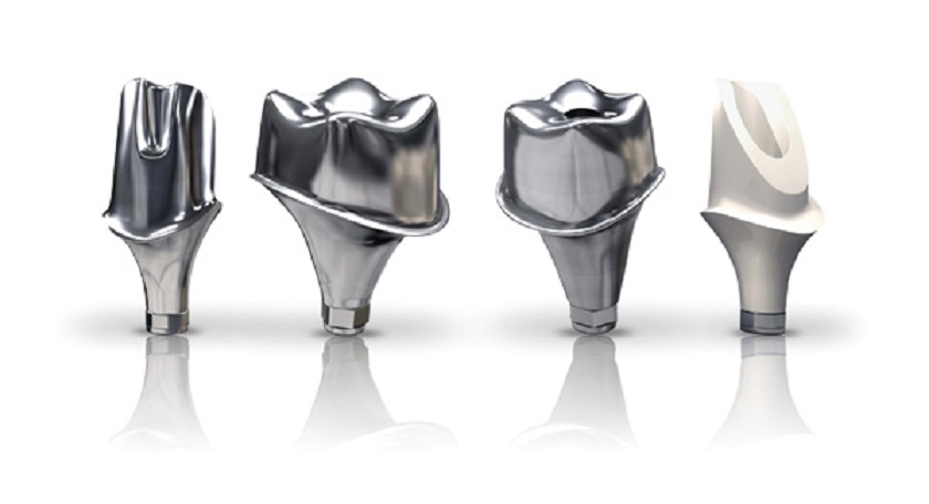 Implant cá nhân hóa là gì?