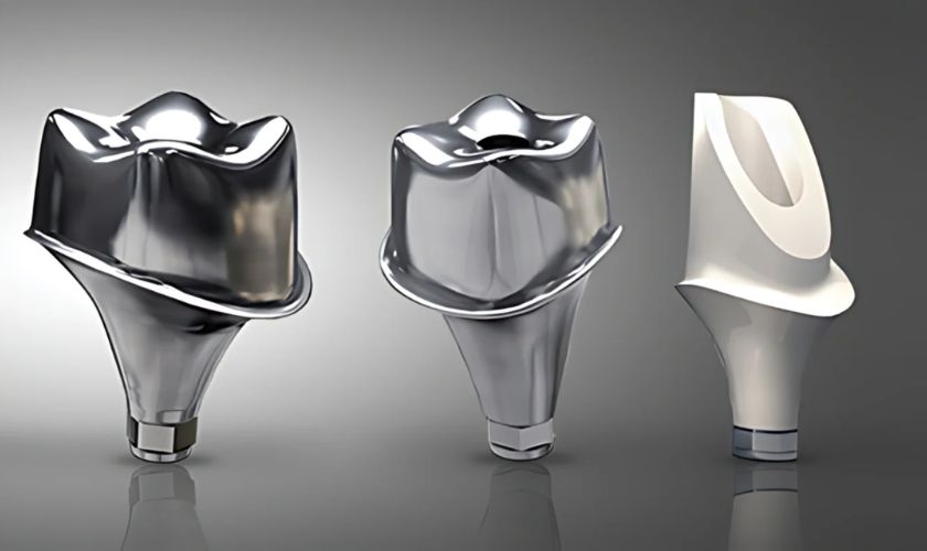 So sánh abutment tiêu chuẩn và abutment cá nhân hóa