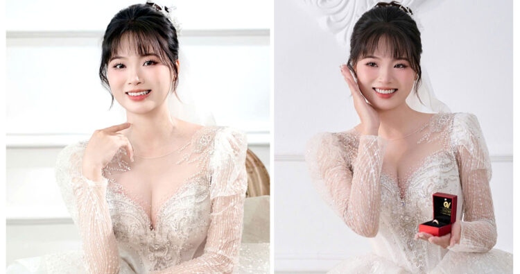 Kết quả trồng răng cửa của bạn Bùi Thị Phương sau 5 tháng