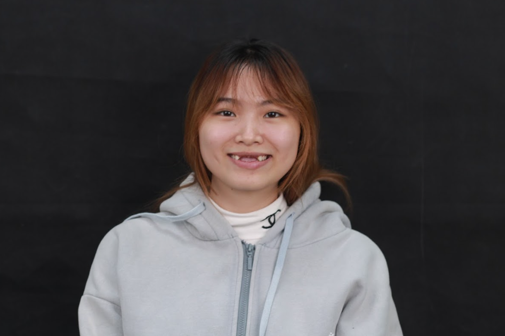 Mất răng cửa khiến cô gái Bùi Thị Phương (SN 2005; Bắc Ninh) trông lớn hơn tuổi do mất răng cửa