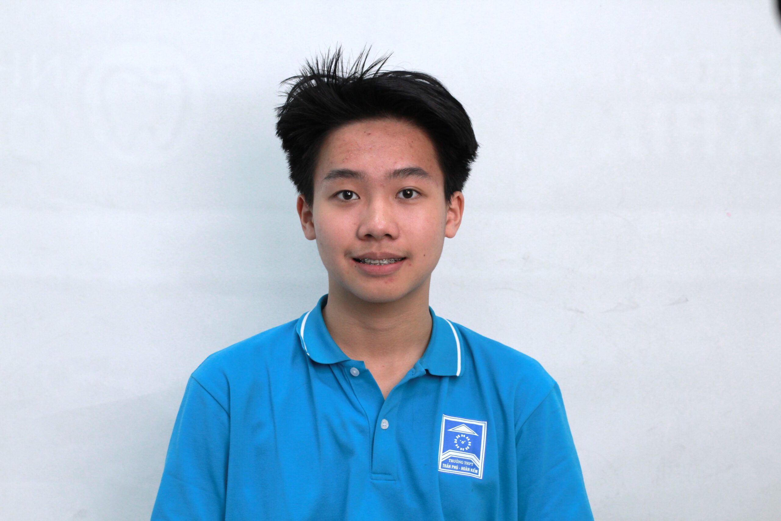 Nhật Minh khi đeo mắc cài tự động sau 2 năm góc chính diện