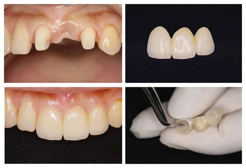 Kỹ thuật thực hiện và tay nghề bác sĩ không đảm bảo