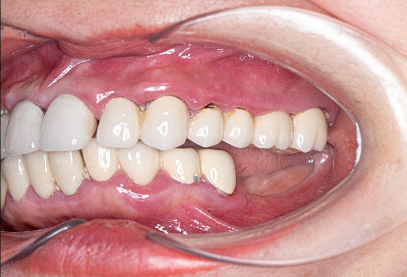 Câu chuyện của cô Lê Thị Thanh Hương: Hành trình 20 năm chịu đựng "cơn ác mộng" răng miệng